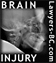preliminary x-ray / ct scan of head for gross injuries 